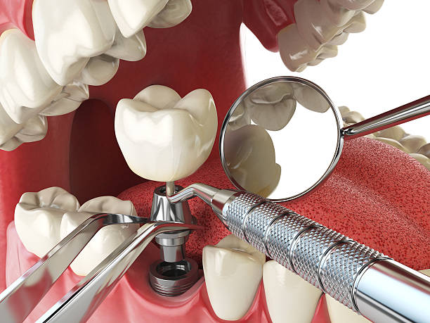 Best Emergency Dental Care for Abscessed Tooth in Elwood, KS